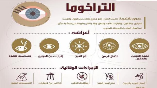 التراخوما عدوى بكتيرية .. الملك فهد الطبية توضح الأعراض والأسباب والوقاية وطرق العلاج