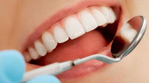 خطوات منزلية للحفاظ على الأسنان نظيفة وصحية