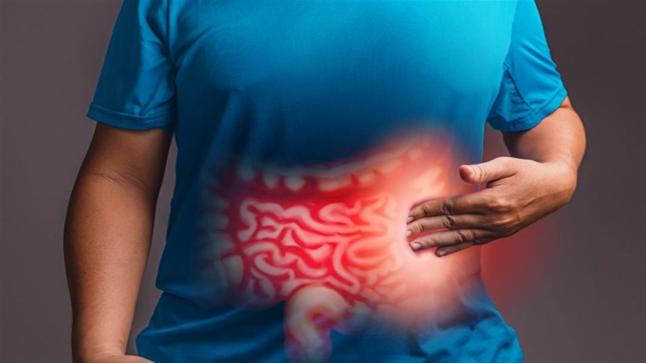 الخضيري يكشف أسباب تهيج القولون